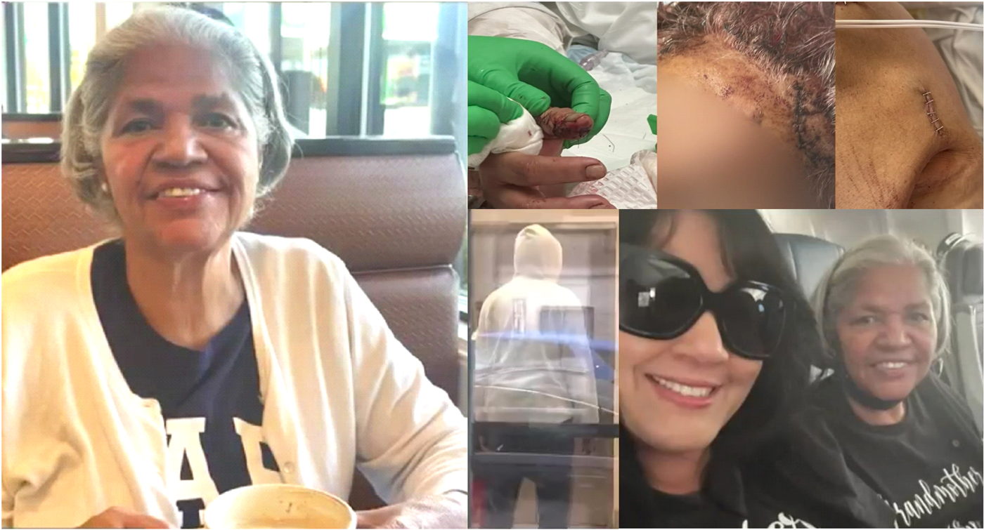 Abuela dominicana sobrevive a puñaladas