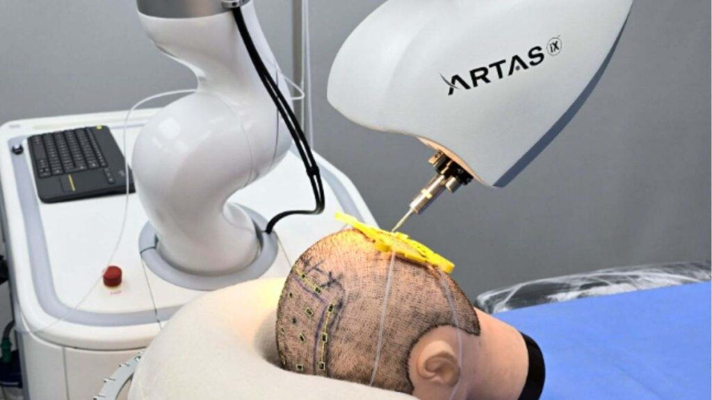 artas-ix-ia